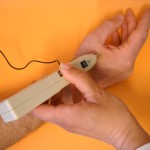 Laseragopuntura: altre metodiche